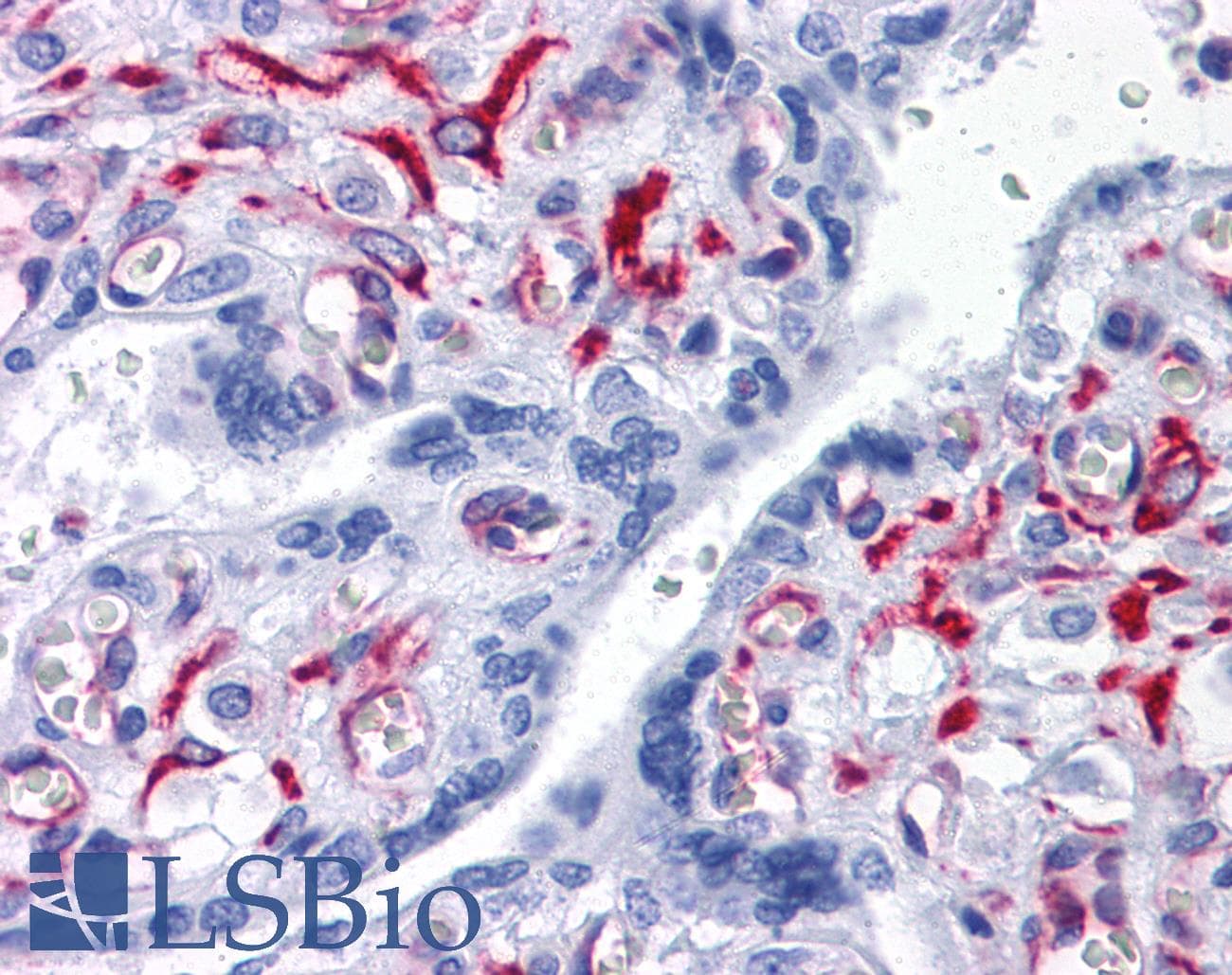 IHC-plus™ SLC44A2 / CTL2 Antibody (clone 3D11)