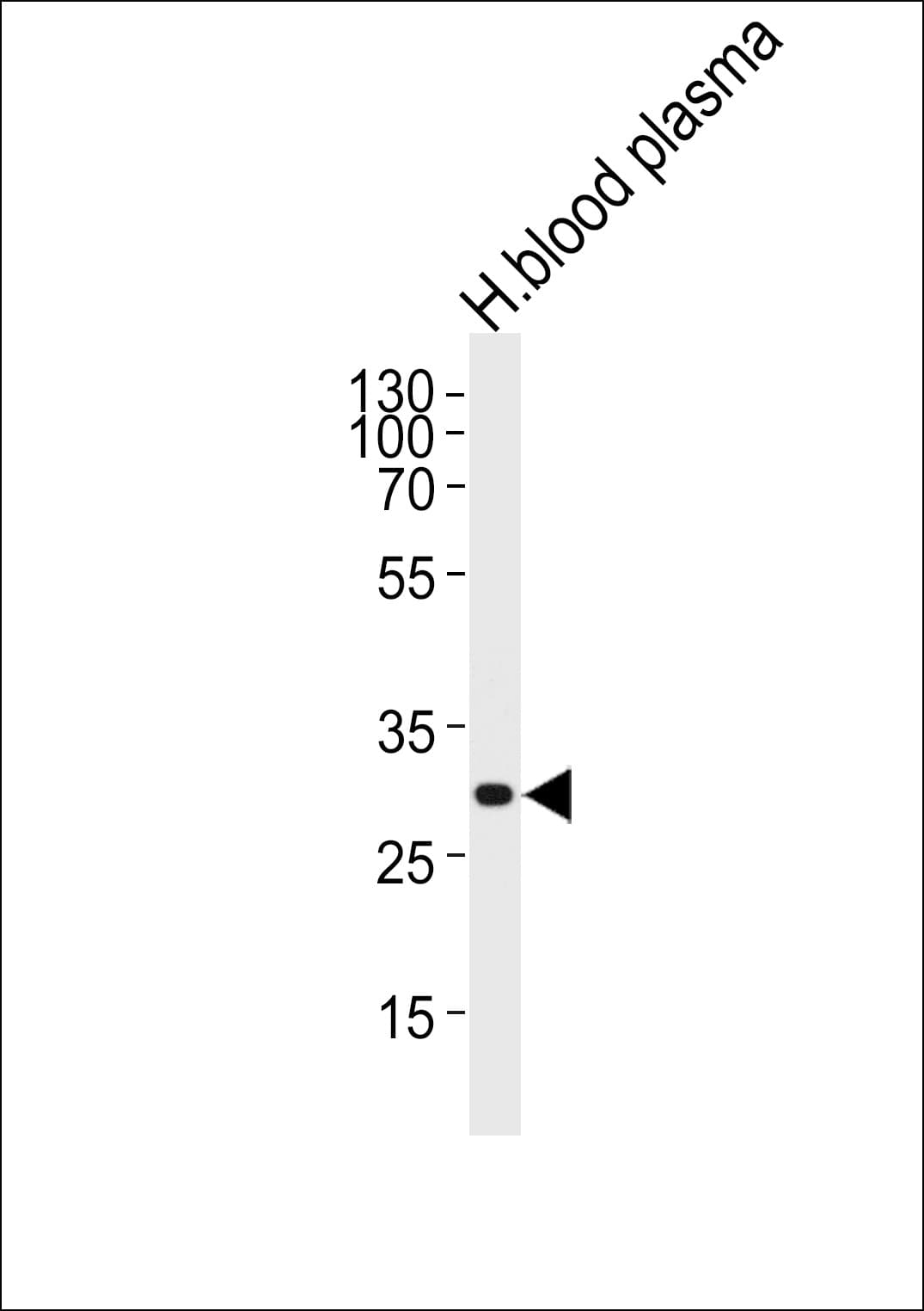 Complement C1QA Antibody (aa89-103)