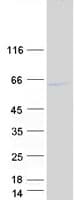 Human HERPUD1 / HERP Protein (Recombinant Myc-DDK (Flag))