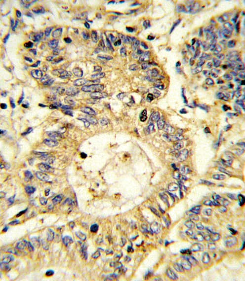 SOCS1 Antibody (aa35-66)