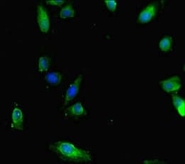 Polyclonal Rabbit anti-Human SMAD1 Antibody (IHC, IF)