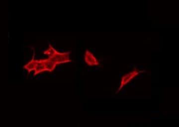 CRFR1 / CRHR1 Antibody