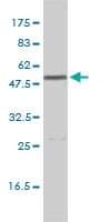 PathPlus™ Monoclonal Mouse anti-Human CALR / Calreticulin Antibody (clone 1G11-1A9, IHC, WB)