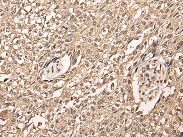 ATF7 Antibody