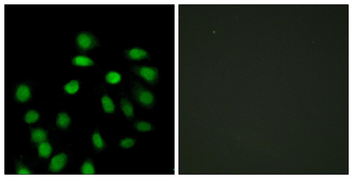 SCAND1 Antibody