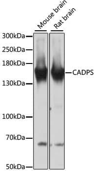 Polyclonal Rabbit anti-Human CADPS Antibody (WB)