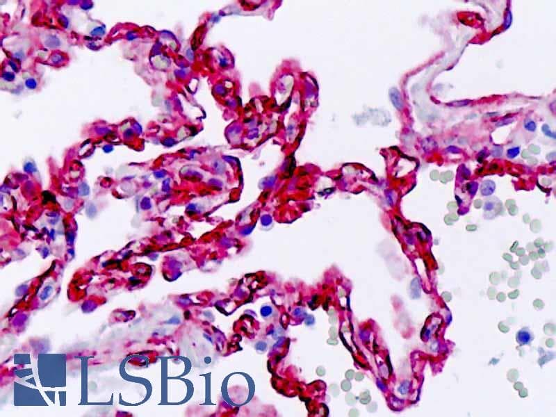 IHC-plus™ Polyclonal Rabbit anti-Human SS18 Antibody (Ala7, IHC, WB)