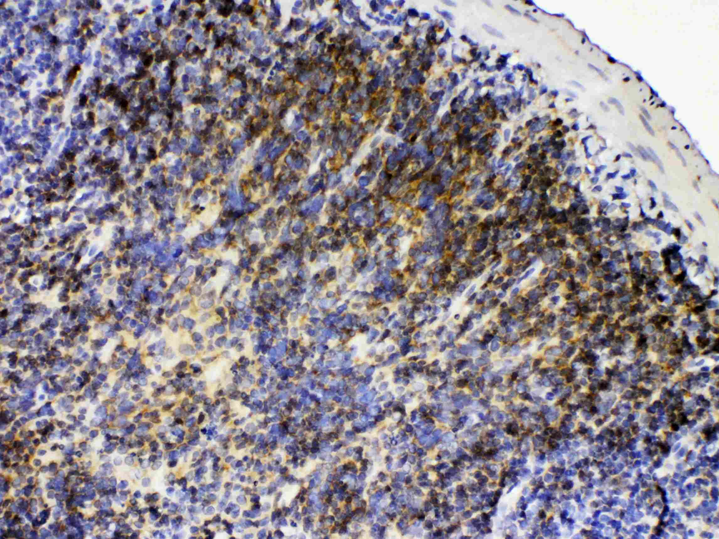 Polyclonal Rabbit anti-Human LYN Antibody (IHC, WB)