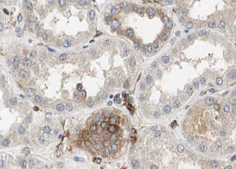 Polyclonal Rabbit anti-Human TIM23 Antibody (IHC, WB)