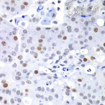 Polyclonal Rabbit anti-Human SF3B2 Antibody (IHC, IF, WB)