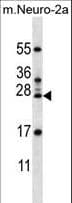 RPL15 / Ribosomal Protein L15 Antibody (aa21-50)