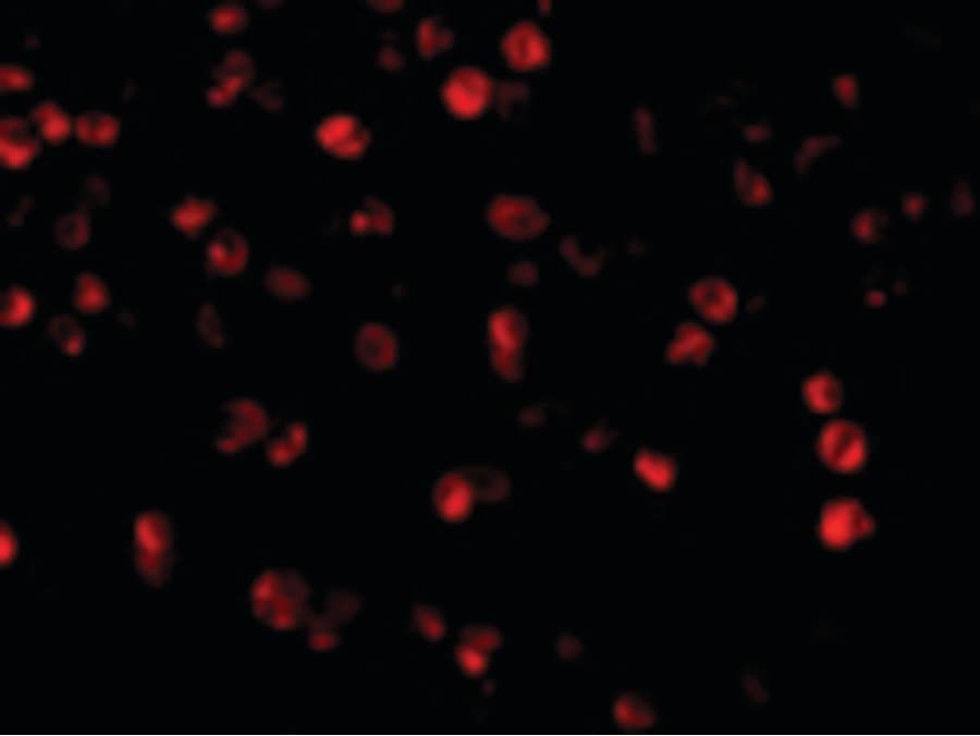 Polyclonal Rabbit anti-Human BECN1 / Beclin-1 Antibody (IHC, IF, WB)