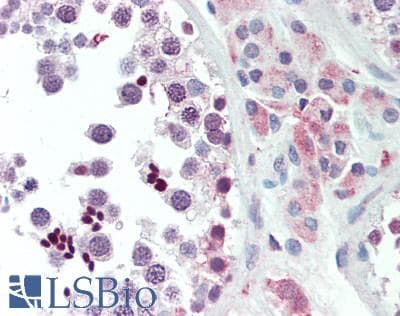 IHC-plus™ ANAPC1 / APC1 Antibody (aa500-550)