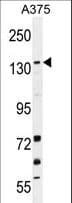 KDM4B / JMJD2B Antibody (aa428-459)