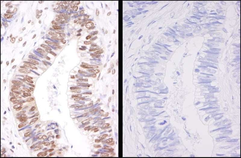 Polyclonal Rabbit anti-Human SMC3 / HCAP Antibody (phospho-Ser1083, IHC)