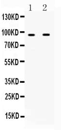 CD119 / IFNGR1 Antibody