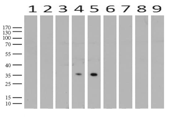 Monoclonal Mouse anti-Human PROCR / EPCR Antibody (clone UMAB201, aa1-210, IHC, WB)