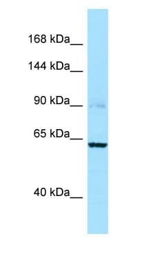 CAPN3 / Calpain 3 Antibody (aa601-650)