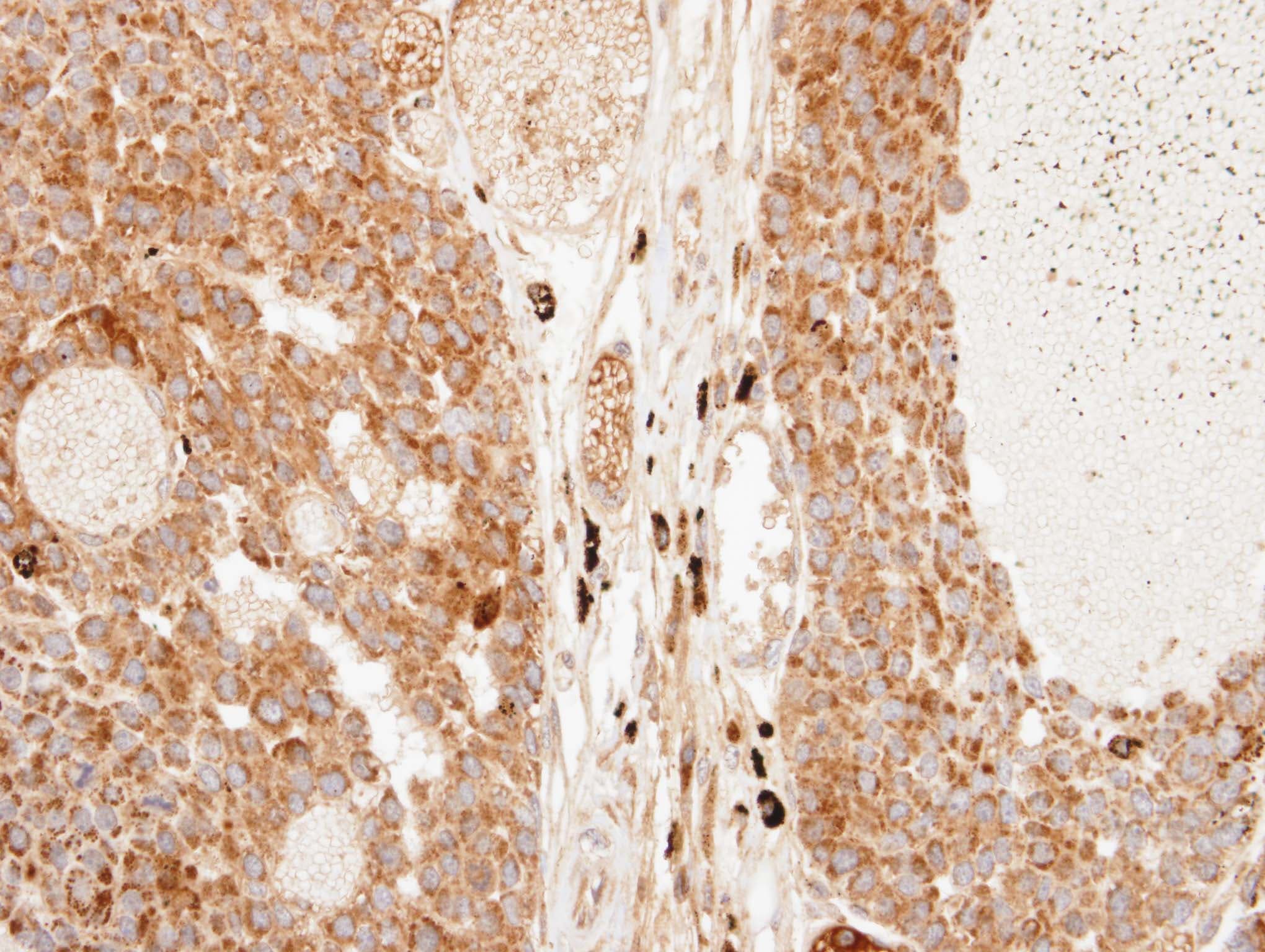 IPO7 / RANBP7 Antibody (aa976-1038)