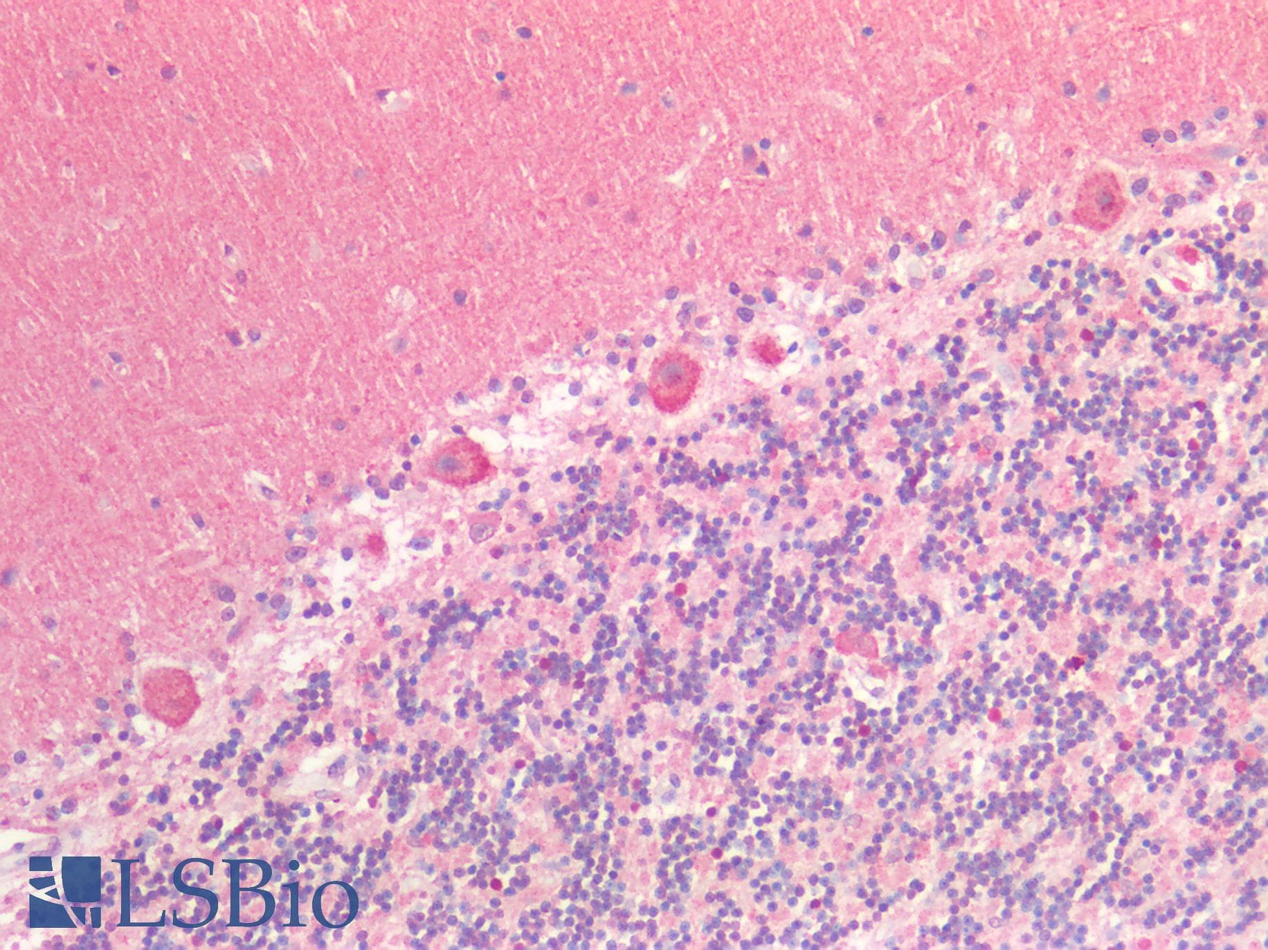 IHC-plus™ Polyclonal Rabbit anti-Human SIRPA / CD172a Antibody (IHC)
