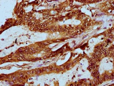 HIST1H2AI Antibody