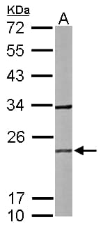 RAB2B Antibody (aa1-216)