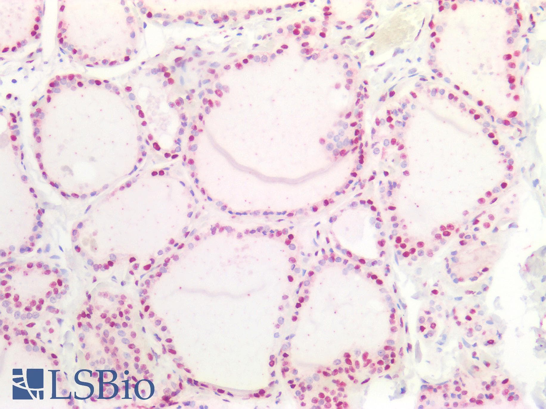 PathPlus™ NPM1 / NPM / Nucleophosmin Antibody (aa204-290)