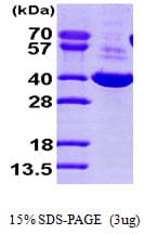 Human DDH / AKR1C1 Protein (Recombinant His)