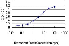 CDKN1A / WAF1 / p21 Antibody (clone 2F1)