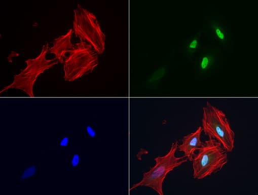 Monoclonal Mouse anti-Human S100P Antibody (clone UMAB24, Carrier-free, IHC, IF, WB)