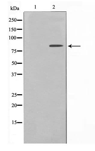 NBN / Nibrin Antibody