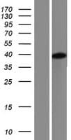 LMNTD1 / IFLTD1 Protein (Over-Expression Lysate Myc-DDK (Flag))