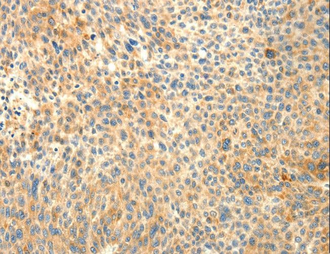Polyclonal Rabbit anti-Human TRAF3IP2 / ACT1 Antibody (IHC, WB)