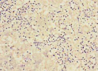 PCDH1 / PCD1 Antibody