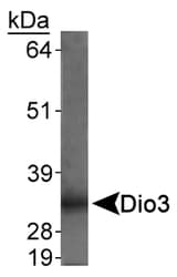 DIO3 Antibody (Internal)