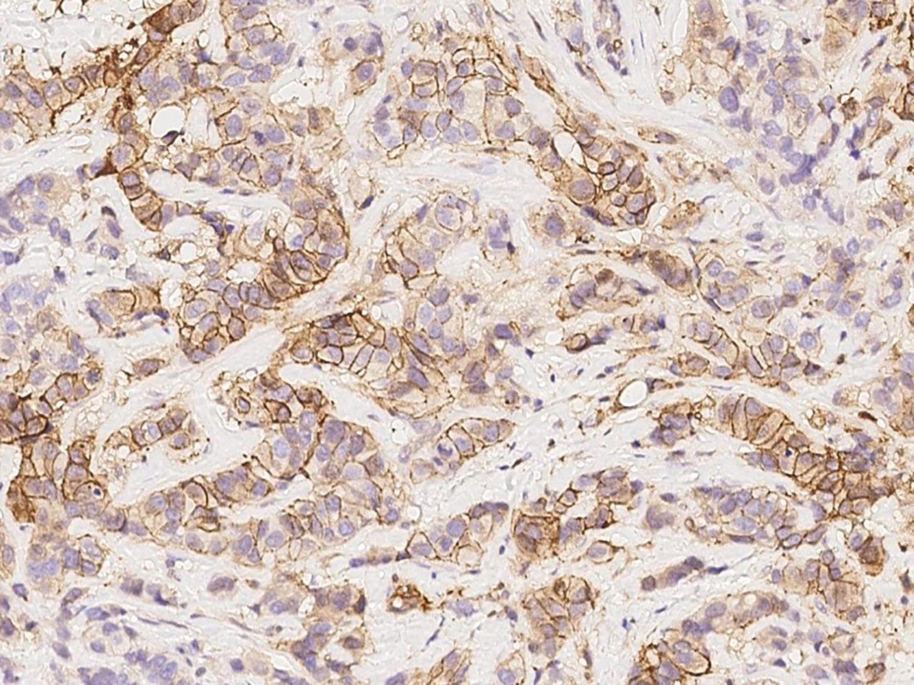 NDRG1 Antibody (Preservative Free)