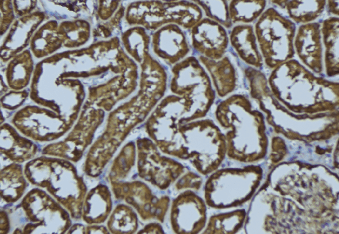 Polyclonal Rabbit anti-Human FUT4 / CD15 Antibody (IHC, WB)