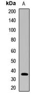 Polyclonal Rabbit anti-Human PHF7 Antibody (WB)
