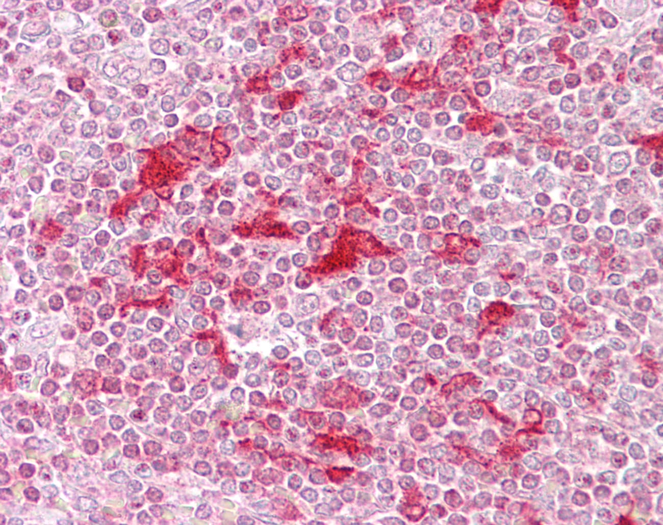 ETV5 / ERM Antibody (aa61-110)