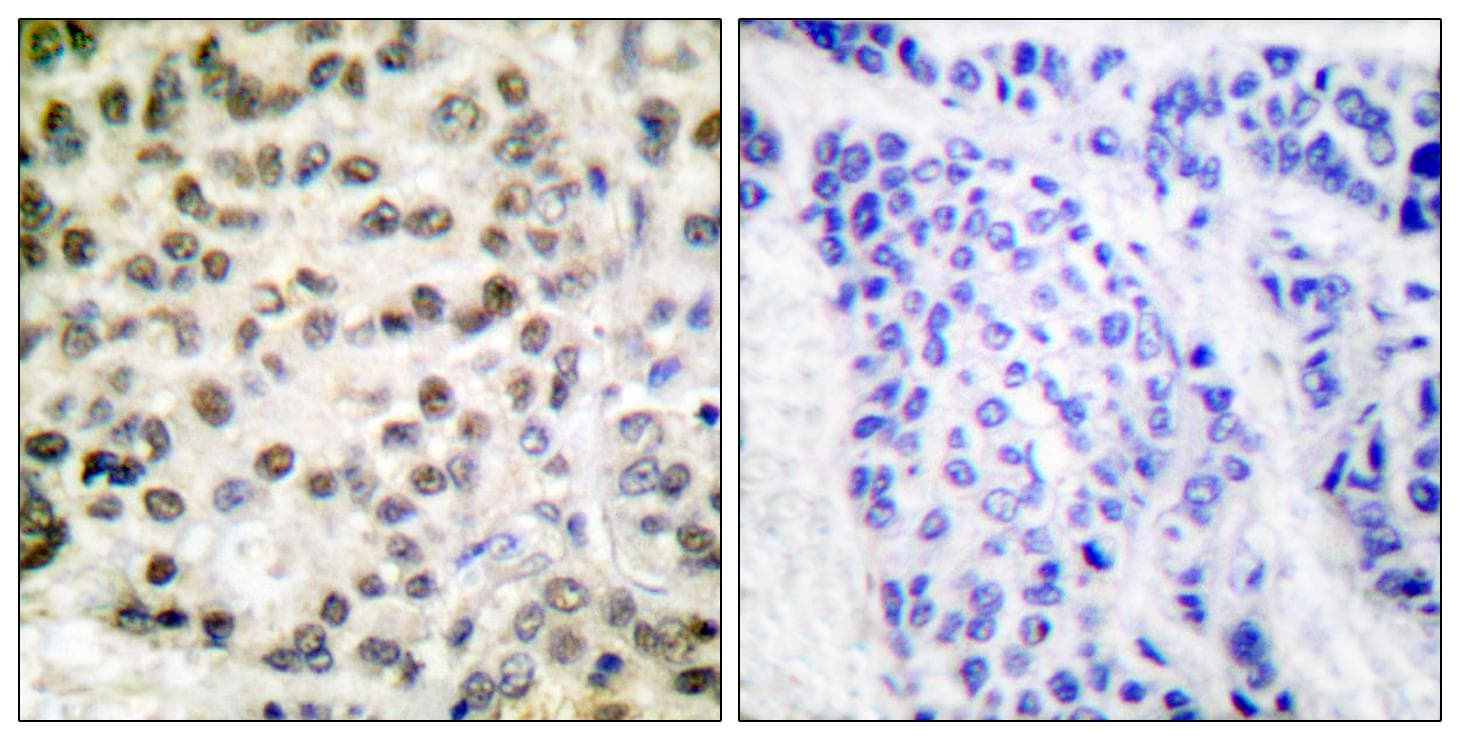 POLR2A / RNA polymerase II Antibody (p1619)