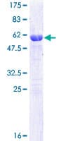 Human CLIC1 / NCC27 Protein (Recombinant GST)