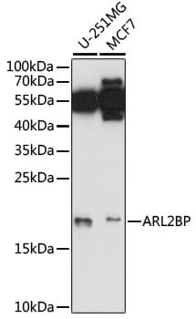 Polyclonal Rabbit anti-Human ARL2BP / BART Antibody (WB)