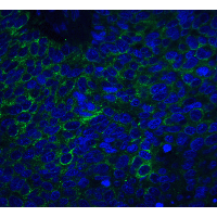 PathPlus™ Polyclonal Rabbit anti-Human NRN1 / Neuritin Antibody (IHC, IF, WB)