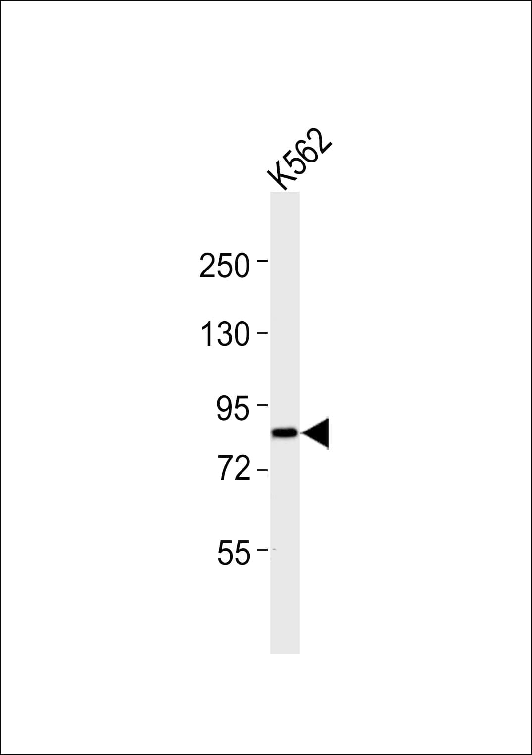 ADD3 Antibody