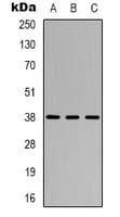 CYSLTR1 / CYSLT1 Antibody (Internal)