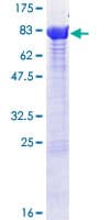 Human PPP2R1B Protein (Recombinant GST)