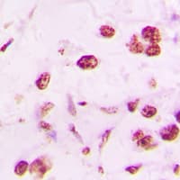 DLX5 Antibody (Internal)