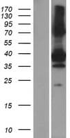 SNX20 Protein (Over-Expression Lysate Myc-DDK (Flag))