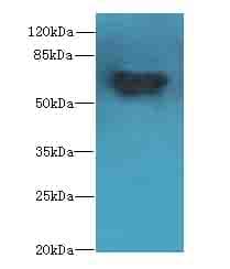 Polyclonal Rabbit anti-Human CHEK2 / CHK2 Antibody (WB)