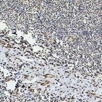 TUBB3 / Tubulin Beta 3 Antibody